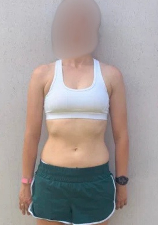 Femme, 35 ans · plus des centimètres de tour de taille, en 6 semaines, Après