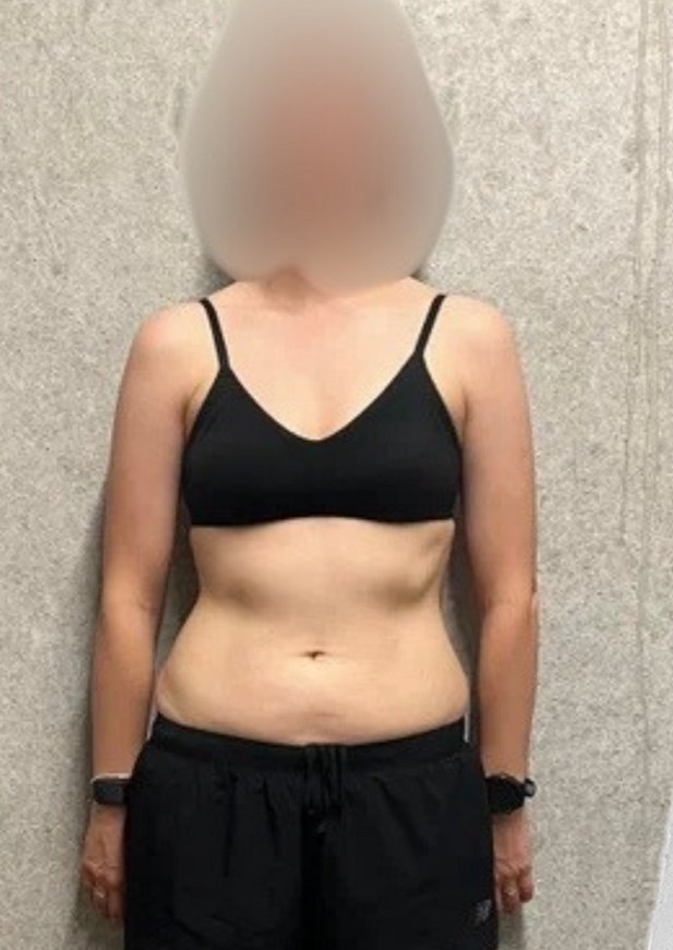 Femme, 35 ans · plus des centimètres de tour de taille, en 6 semaines, Avant